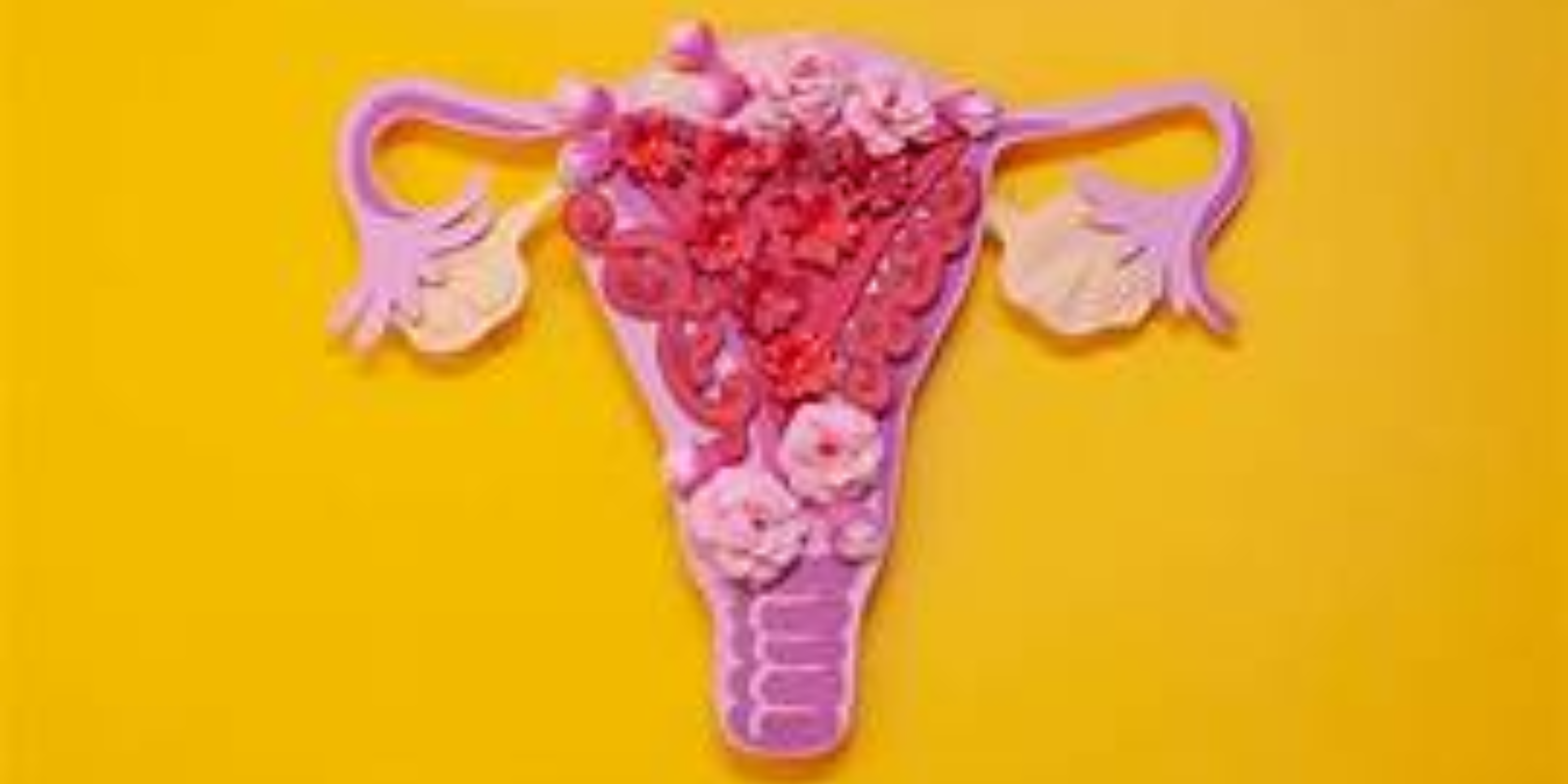 Endometriose: Was du wissen musst, wenn deine Periode zur Hölle wird